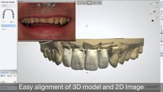 RealView Engine im WIELAND 3shape DentalSystem 2013