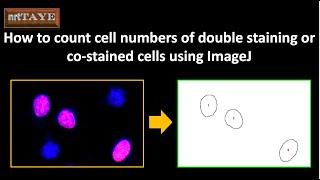 How to count the cell numbers of double staining or co-stained cells using ImageJ