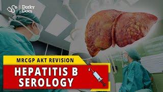 Hepatitis B Serology | MRCGP AKT Revision - Dorky Docs