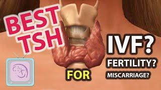 Subclinical hypothyroidism: IVF-Infertility-miscarriage