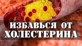 Как быстро снизить холестерин в домашних условиях? Записывайте рецепт.