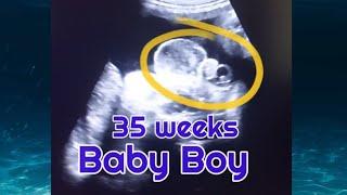 35 weeks baby boy scan | Gender reveal in 8month | Baby Boy | how to tell gender on ultrasoumd | usg