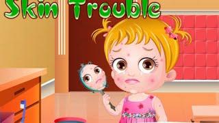 Baby Hazel Skin Trouble - Baby Hazel Games To Play - yourchannelkids