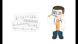 Making sense of common Holter ECG findings