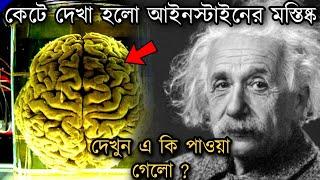 স্যার আইনস্টাইনের বুদ্ধির আসল কারণ কি ছিল? How Albert Einstein Brain Is Really Different Than Others