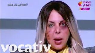 A Battered Face Raises Awareness Of Domestic Violence On Egyptian TV