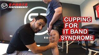 IT Band Syndrome Cupping Therapy | Knee Pain Treatment | Sports Performance Physical Therapy