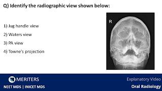 NEET MDS | INICET - Oral Radiology - Extraoral Radiography | Explanatory Video | MERITERS