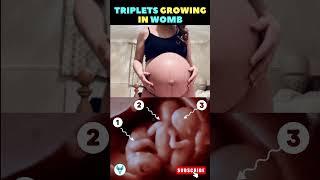 Triplets growing inside Mom's Womb   Triplets | Pregnancy week by week #shortsvideo #baby #triplets