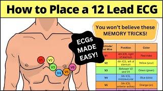 12 Lead ECG Placement MADE EASY [EMT, Nursing, Paramedic] #ecg #nursing