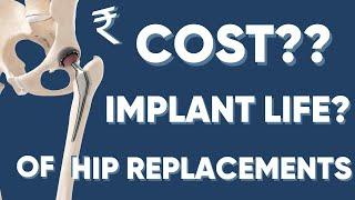 What’s the Cost of Hip Replacement in India ? || Lifespan of hip replacement Implant in Life Years