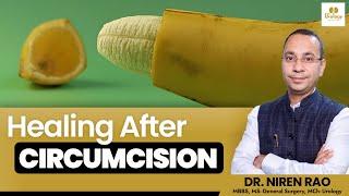 Healing Process after Circumcision (हिंदी में) | Circumcision Procedure | Delhi Urology Hospital