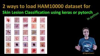 202 - Two ways to read HAM10000 dataset into python for skin cancer lesion classification