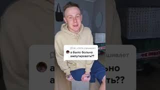 Больно ли было ампутировать ногу?