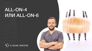 Имплантация All-on-4 и All-on-6: какая лучше?