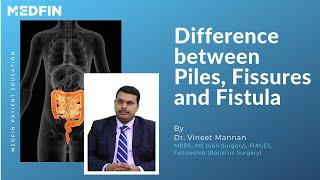 What is the difference between Piles, Fissures and Fistula?