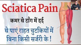 Sciatica Pain , पैरों की जलन ,कमर में दर्द से पाएं राहत चुटकियों में बिना किसी सर्जरी के |Dr Darbesh