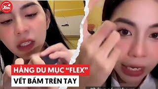 Hằng Du Mục tinh ý “flex” vết bầm trên tay, che được vết bầm nhưng không che được vết thương lòng