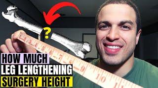 How much Limb Lengthening Height is safe to gain