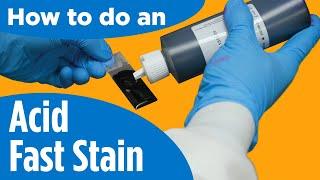 How to do an Acid-Fast Stain - Instructions for the lab/procedure