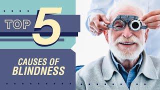 Top 5 Causes Of Blindness