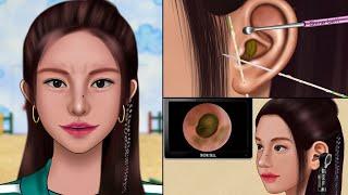 ASMR Squid game Player 196 Ear Cleaning Animation , Blackhead, Removing Pus from Piercing