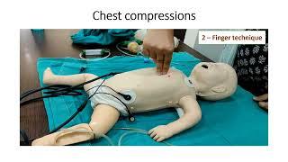 Chest Compression | Two-finger Technique | Pediatrics