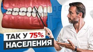 Самый популярный вид неправильного прикуса у человека #3 | Дистальный прикус