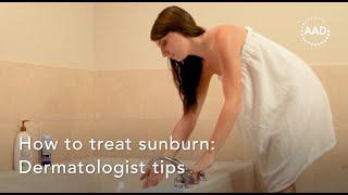 How to treat a sunburn: Dermatologist tips