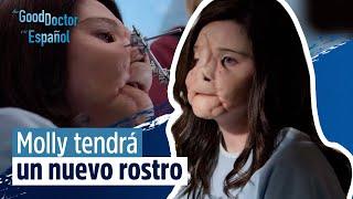 Reconstrucción facial para Molly | Capítulo 14 | Temporada 2 | The Good Doctor en Español