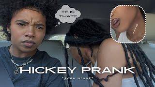 hickey prank on my gf!! | *GONE WRONG* :(