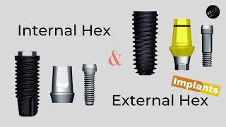 External & Internal Hex Implant Connections Explained!