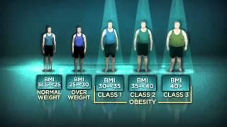 BEING OVERWEIGHT ASSOCIATED WITH SLIGHTLY LOWER ALL-CAUSE MORTALITY RELATIVE TO NORMAL WEIGHT