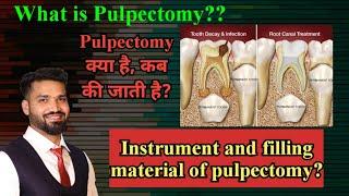 Pulpectomy! Indication, material used and procedure?? (HINDI)