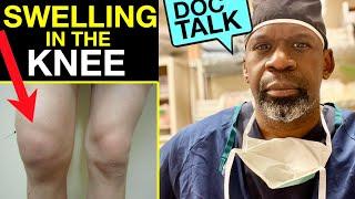 SWELLING IN THE KNEE | Why You Get It & How To Treat It With Orthopedic Surgeon Dr. Chris Raynor