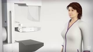 Mammogram for Breast Cancer - What to Expect