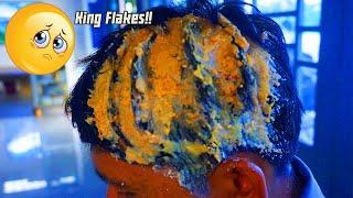 Huge Itchy Dry Scalp Of Dandruff Scratching | Combing Big Flakes #286