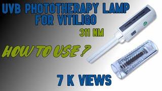 Narrow band UVB light for Vitiligo | 311 NM | Psoriasis Treatment at Home