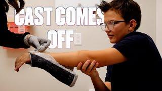 GETTING CAST OFF BROKEN ARM | BOTH ARM BONES BROKEN CAST REMOVED | TAKING OFF BROKEN ARM CAST