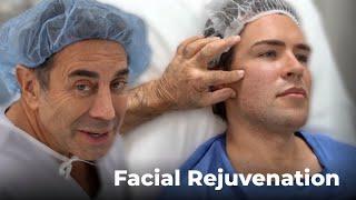 Male Facial Rejuvenation with Dr. Paul Nassif