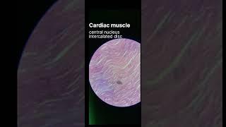 How to identify Cardiac muscles Histology slide #learnanatomywithfun #anatomy #anatomymadeeasy