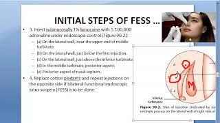 ENT FESS Surgery STEPS Approach how is it done complications post operative care operation