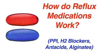 How Do Reflux Medications Work? (PPI, H2 Blockers, Antacids, Alginates)