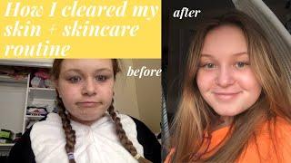 my affordable skincare routine that cleared my face!