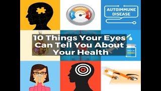 10 Things Your Eyes Can Tell You About Your Health