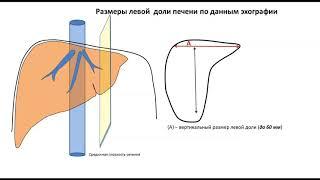 Лекция: Размеры печени  (с демонстрацией на пациенте)