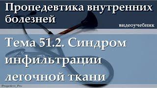 Тема 51.2. Синдром инфильтрации легочной ткани.