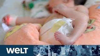 MAINZER UNIMEDIZIN: Ärzte äußert sich zu Fehlbildungen bei Babys