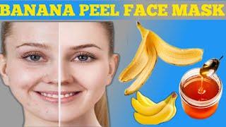 HOW TO REMOVE DARK CIRCLES UNDER EYES |REMOVE PIMPLES , ANCE & PIGMENTATION , BLEMISHES | REMOVE TAN