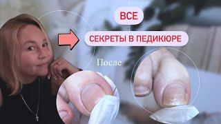 Зачем нужен педикюр в осенне зимний сезон ?! / И почему он так важен ? #педикюр #эстетикавпедикюре